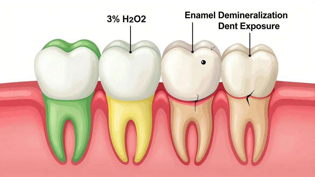 Křížový řez zubu ukazující poškození sklovinky způsobené příliš častým používáním peroxidu vodíku.