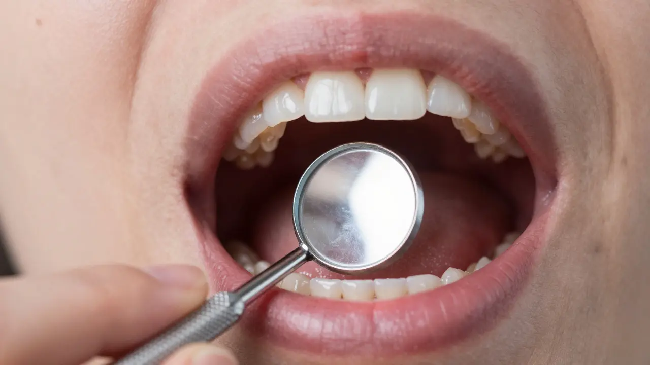 Záběr do úst s dentálním zrcátkem při kontrole zadních zubů